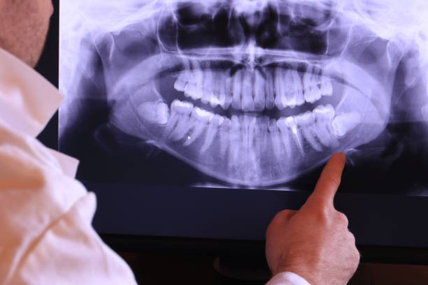 Best Emergency Treatment for Oral Infections in Corydon, IN
