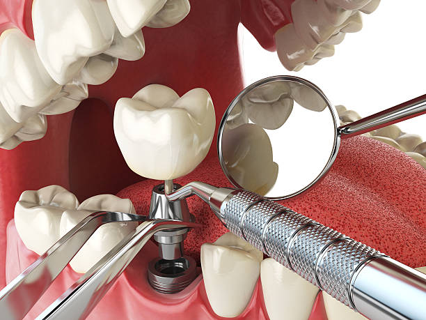 Best Weekend Emergency Dental Services in Corydon, IN