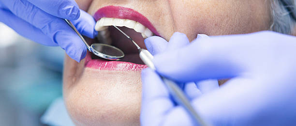 Best Emergency Dental Care for Sports Injuries in Corydon, IN